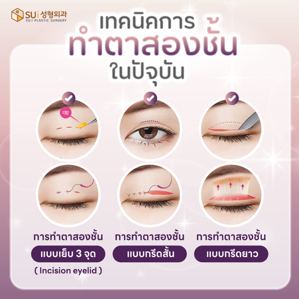 เทคนิคการทำตาสองชั้น