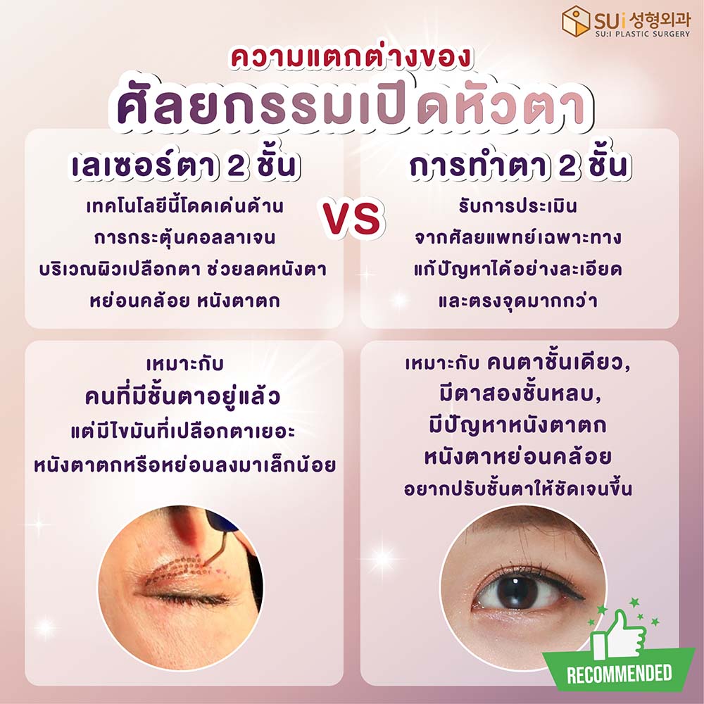 เทคนิคการผ่าตัดเปิดหัวตา Vs เลเซอร์