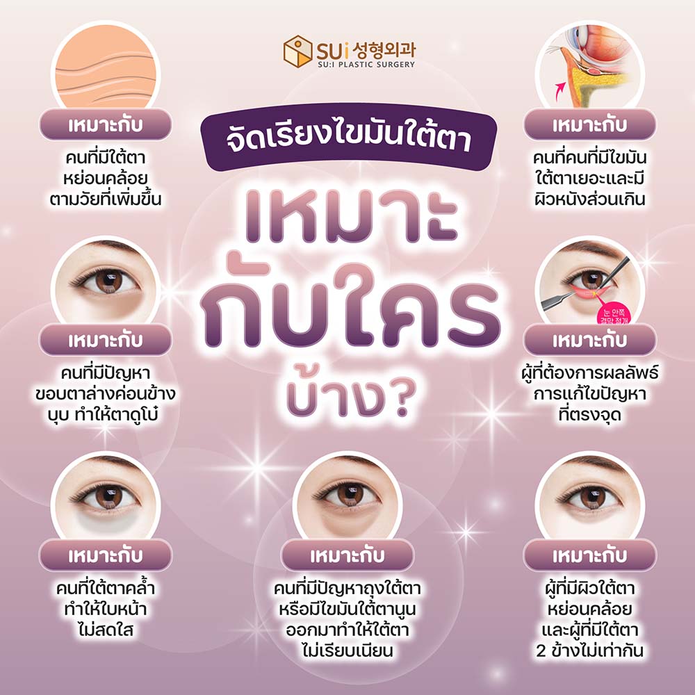 จัดเรียงไขมันใต้ตา เหมาะกับใคร