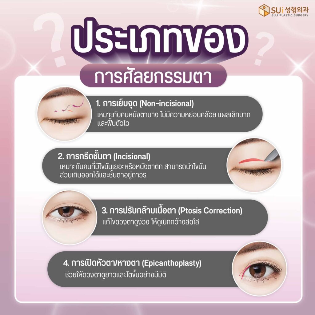 ศัลยกรรมตามีอะไรบ้าง