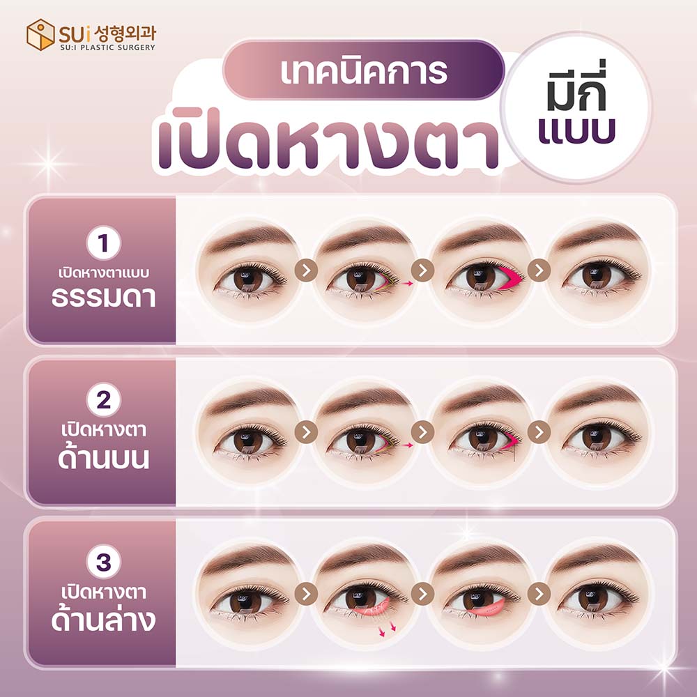 เทคนิคการเปิดหางตา