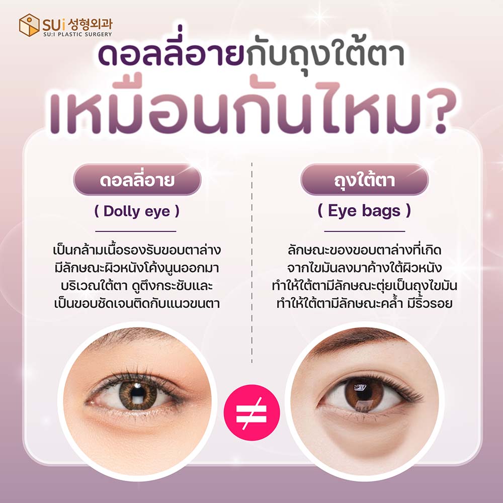 ดอลลี่อาย กับ ถุงใต้ตา