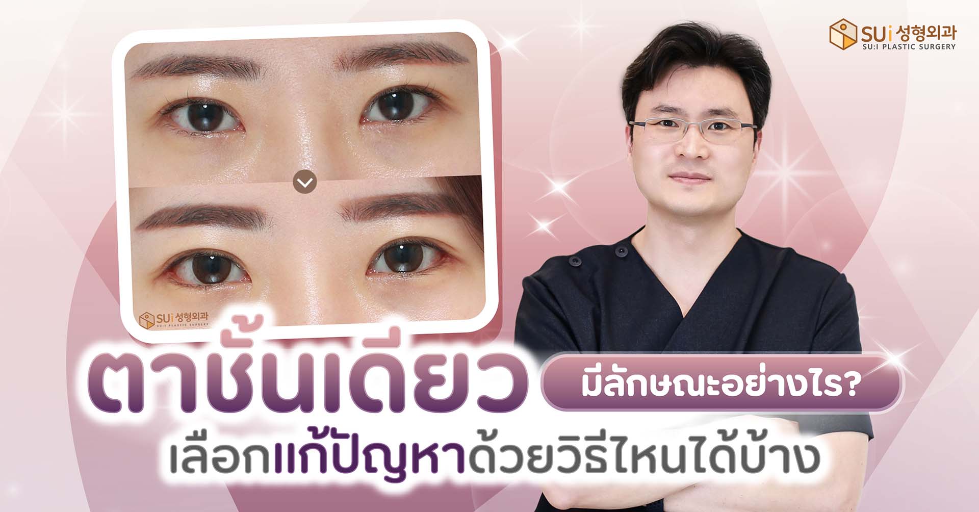ตาชั้นเดียว แก้ด้วยวิธีไหนดี
