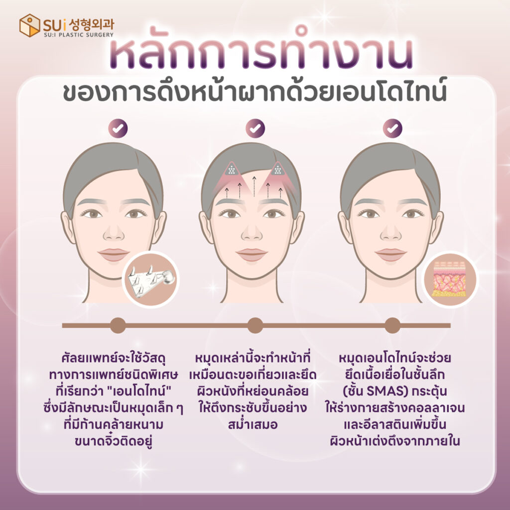 หลักการดึงหน้าด้วยเอนโดไทน์