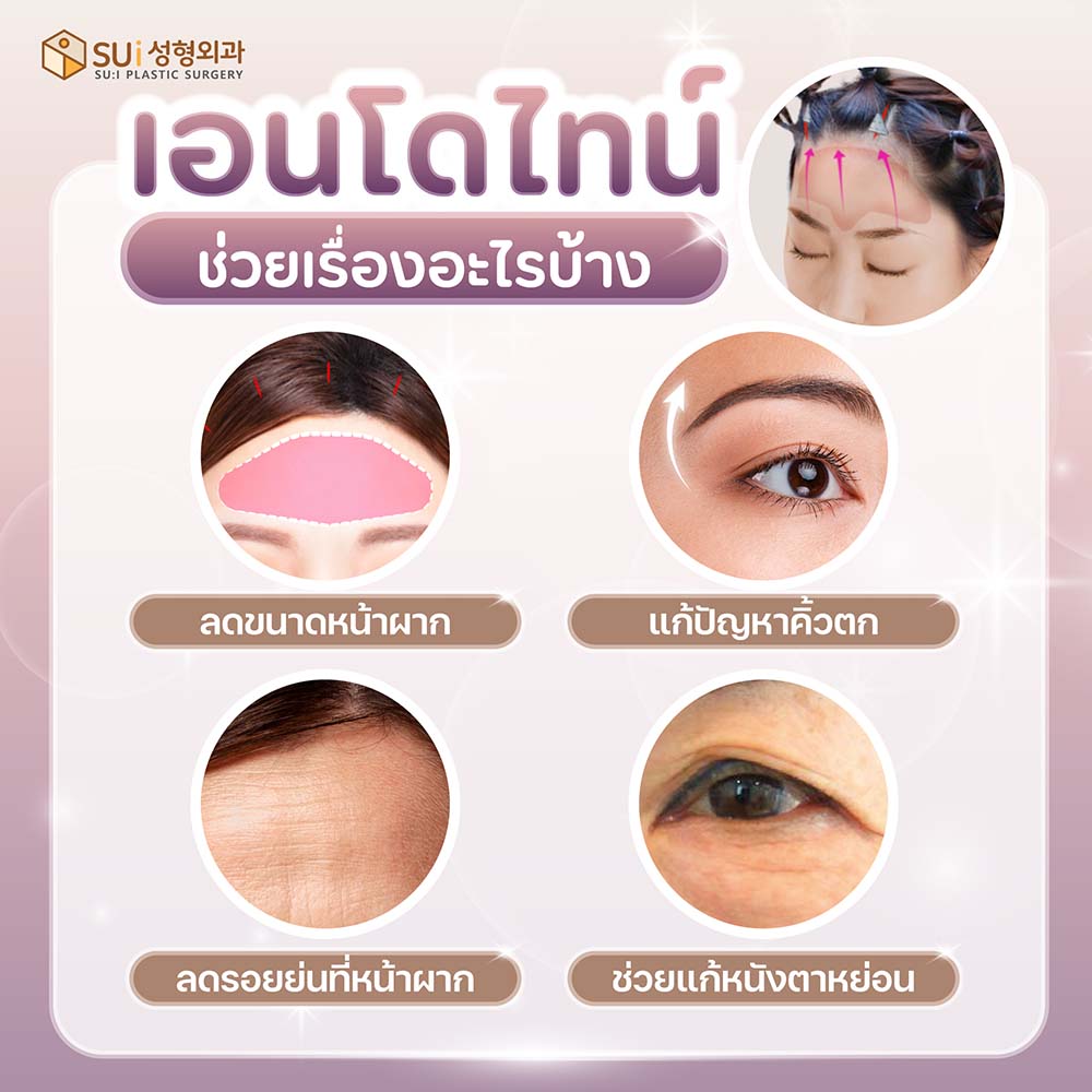 เอนโดไทน์ ช่วยอะไร