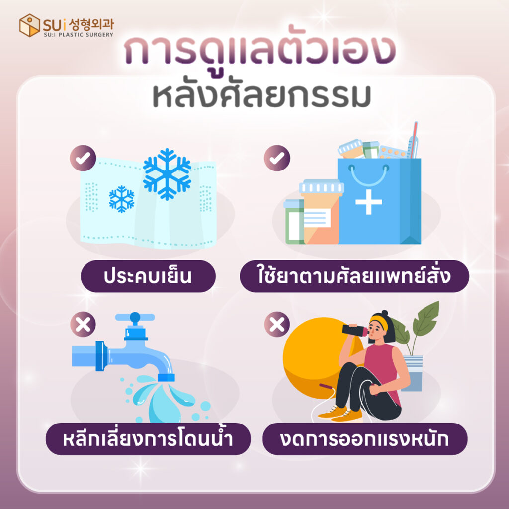 การดูแลตัวเองหลังศัลยกรรมแก้หนังตาตก