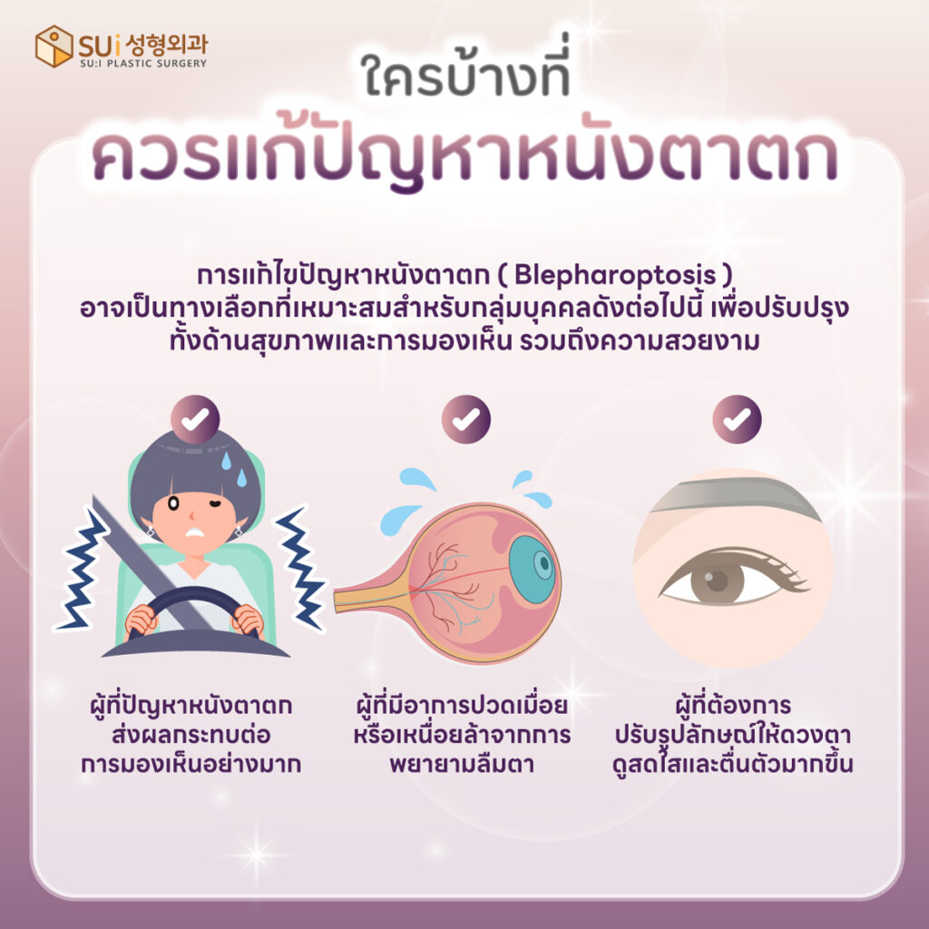 ใครบ้างที่ควรแก้ปัญหาหนังตาตก