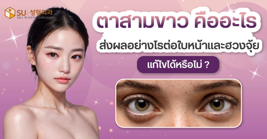 ตาสามขาว