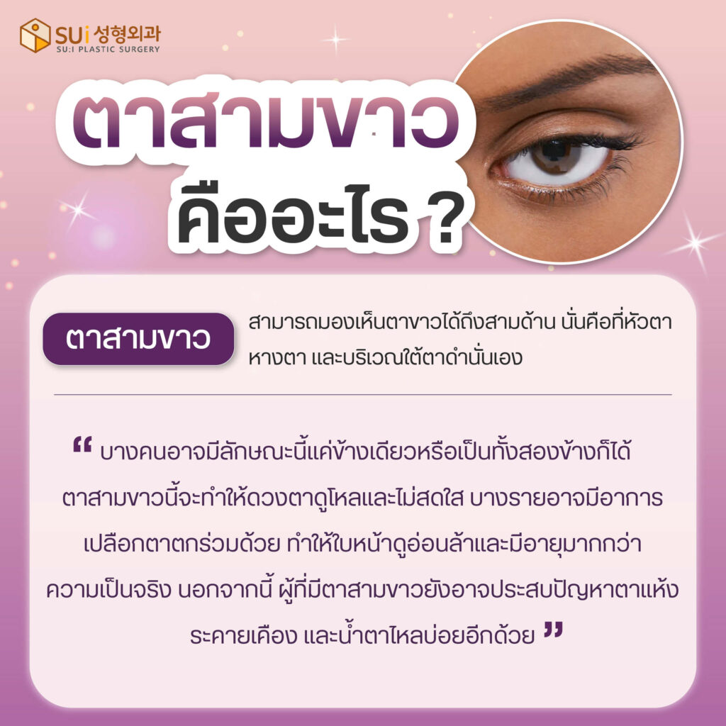 ตาสามขาว คืออะไร