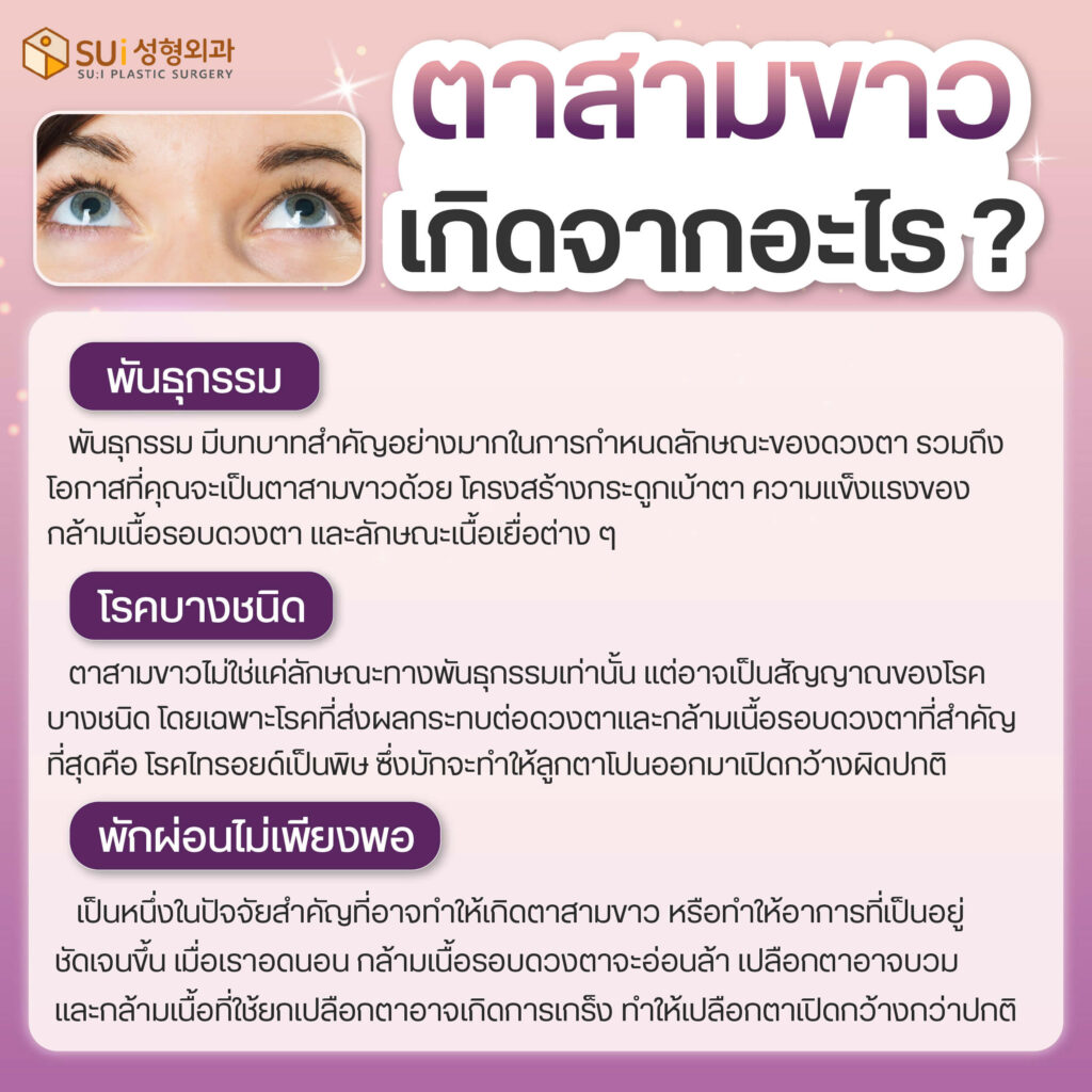 ตาสามขาว เกิดจากอะไร