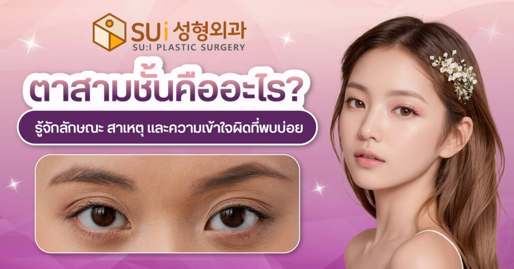 ตาสามชั้น รู้จัก สาเหตุและลักษณะ