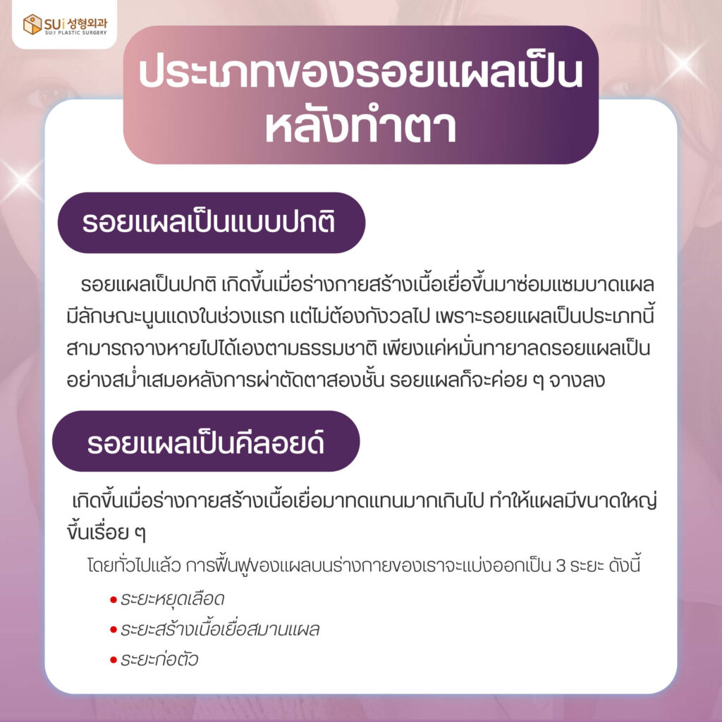 รอบแผลเป็นหลังทำตาสองชั้น