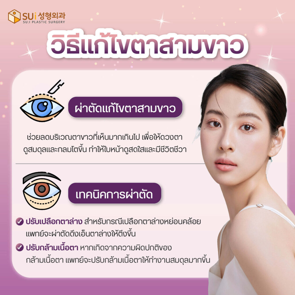 วิธีแก้ ตาสามขาว