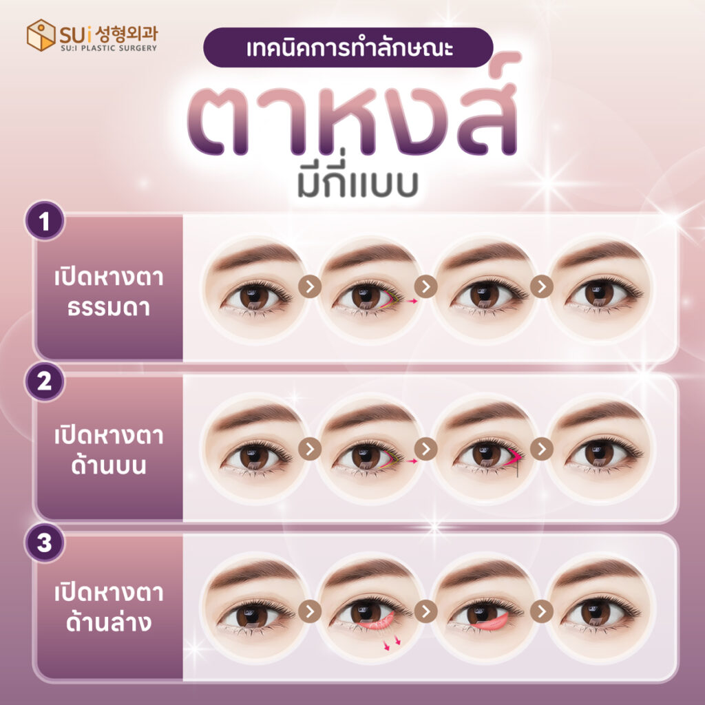 ตาหงส์ มีกี่แบบ