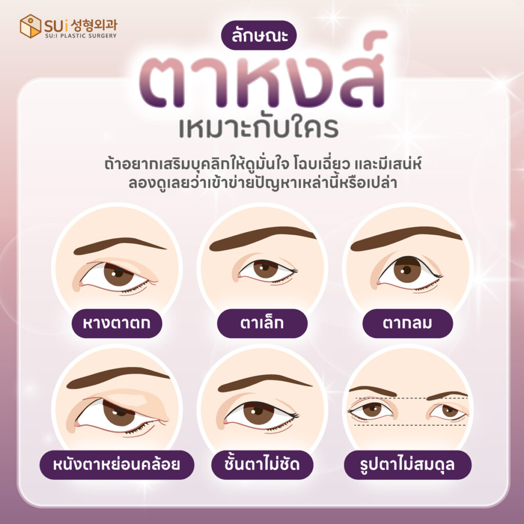ตาหงส์เหมาะกับใคร