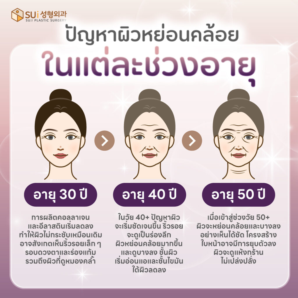 ปัญหาผิวหย่อนคล้อย ในแต่ละช่วงอายุ