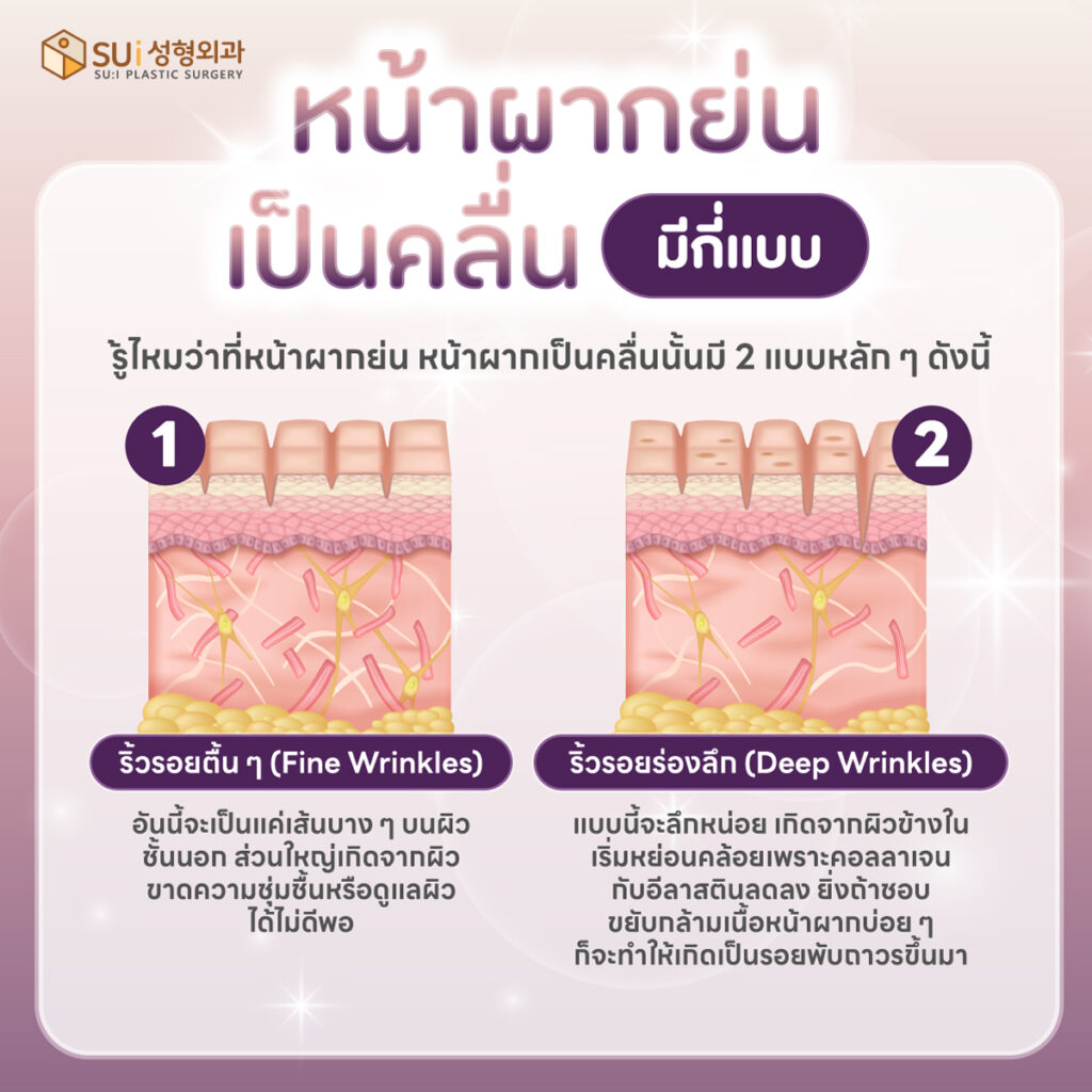 หน้าผากย่นเป็นคลื่น มีกี่แบบ