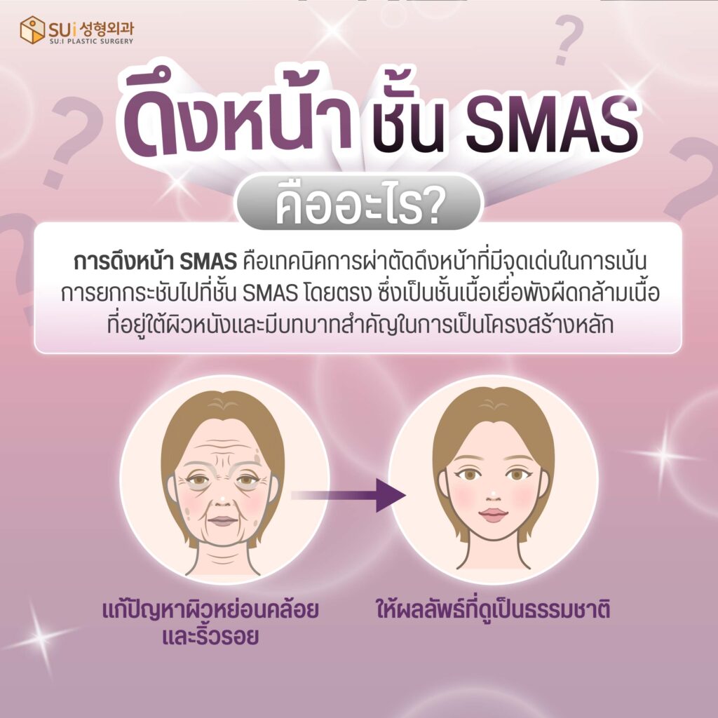 ดึงหน้า ชั้น SMAS คืออะไร? ทำไมต้องชั้นนี้ ต่างจากดึงหน้าทั่วไปยังไง ...
