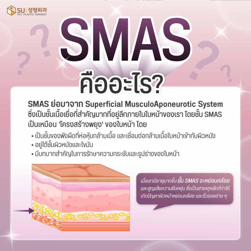 smas คือ