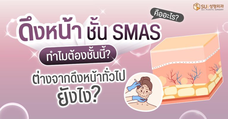 ดึงหน้าชั้น smas