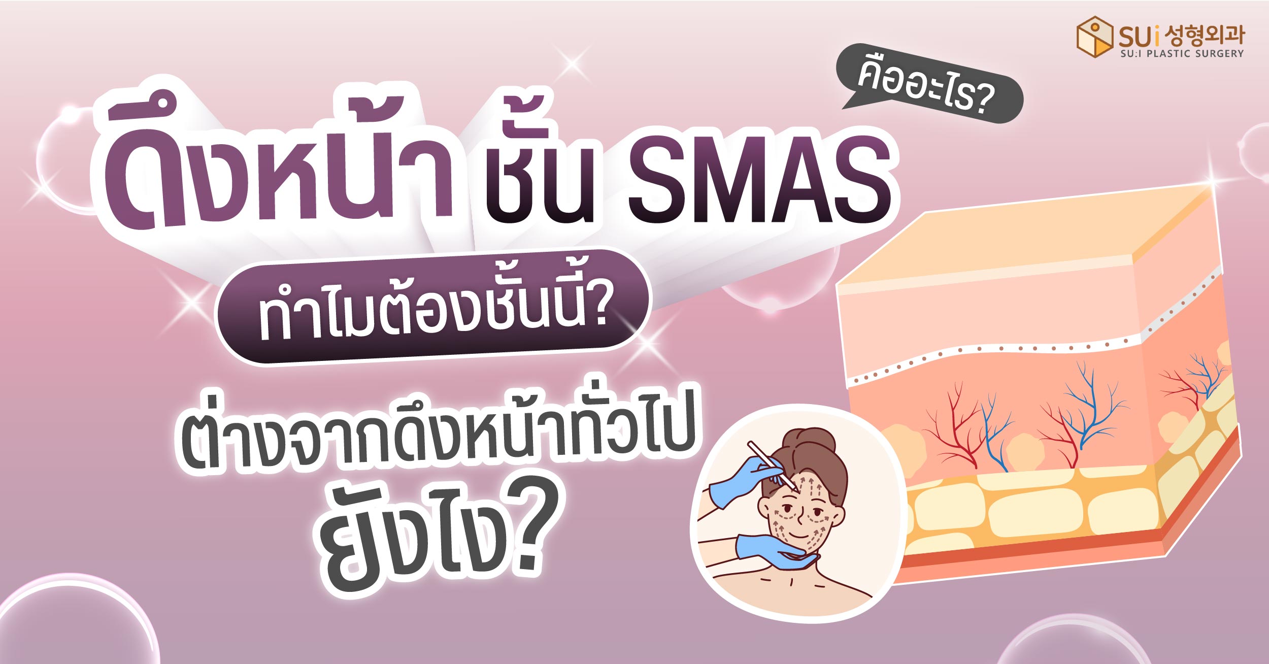 ดึงหน้าชั้น smas