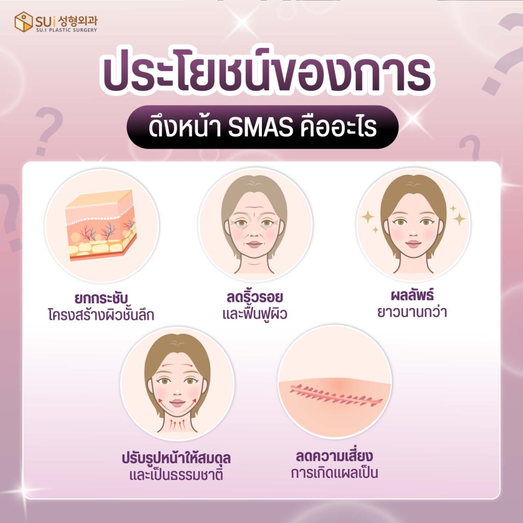 ดึงหน้าชั้นsmas ประโยชน์