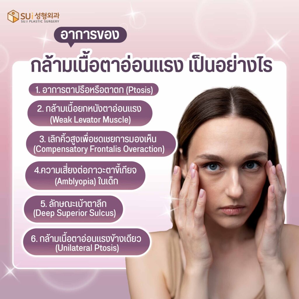 กล้ามเนื้อตาอ่อนแรงเป็นอย่างไร