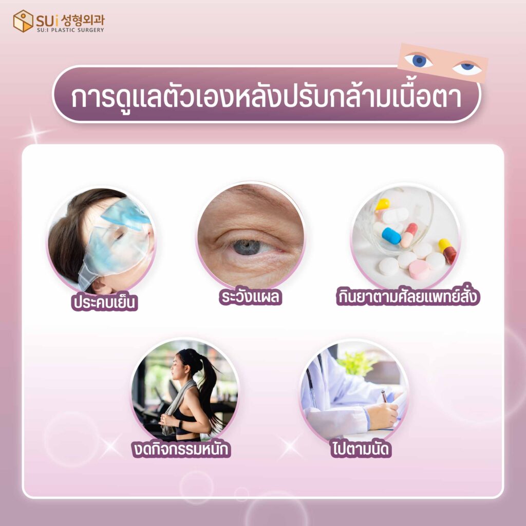 การดูแลตัวเองหลังปรับกล้ามเนื้อตา