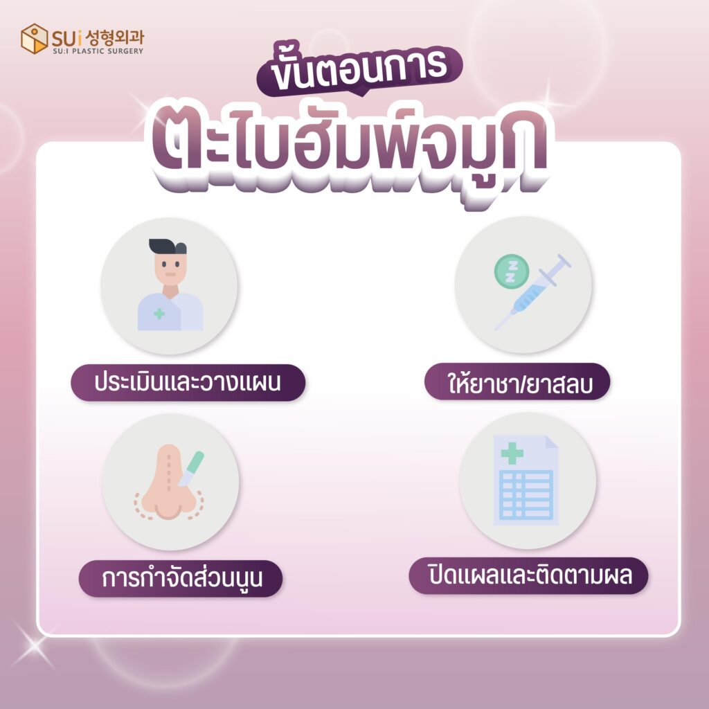 ขั้นตอนการตะไบฮัมพ์