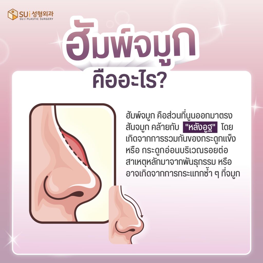 ตะไบฮัมพ์ คืออะไร