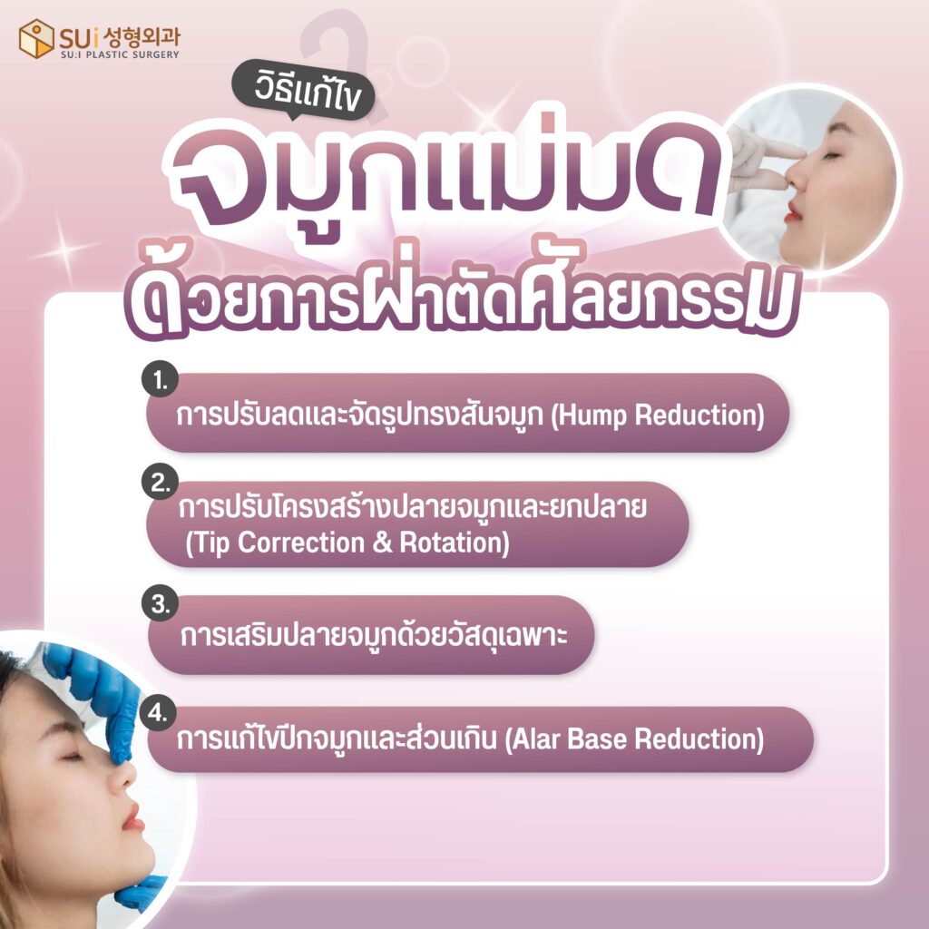 ศัลยกรรมแก้จมูกแม่มด