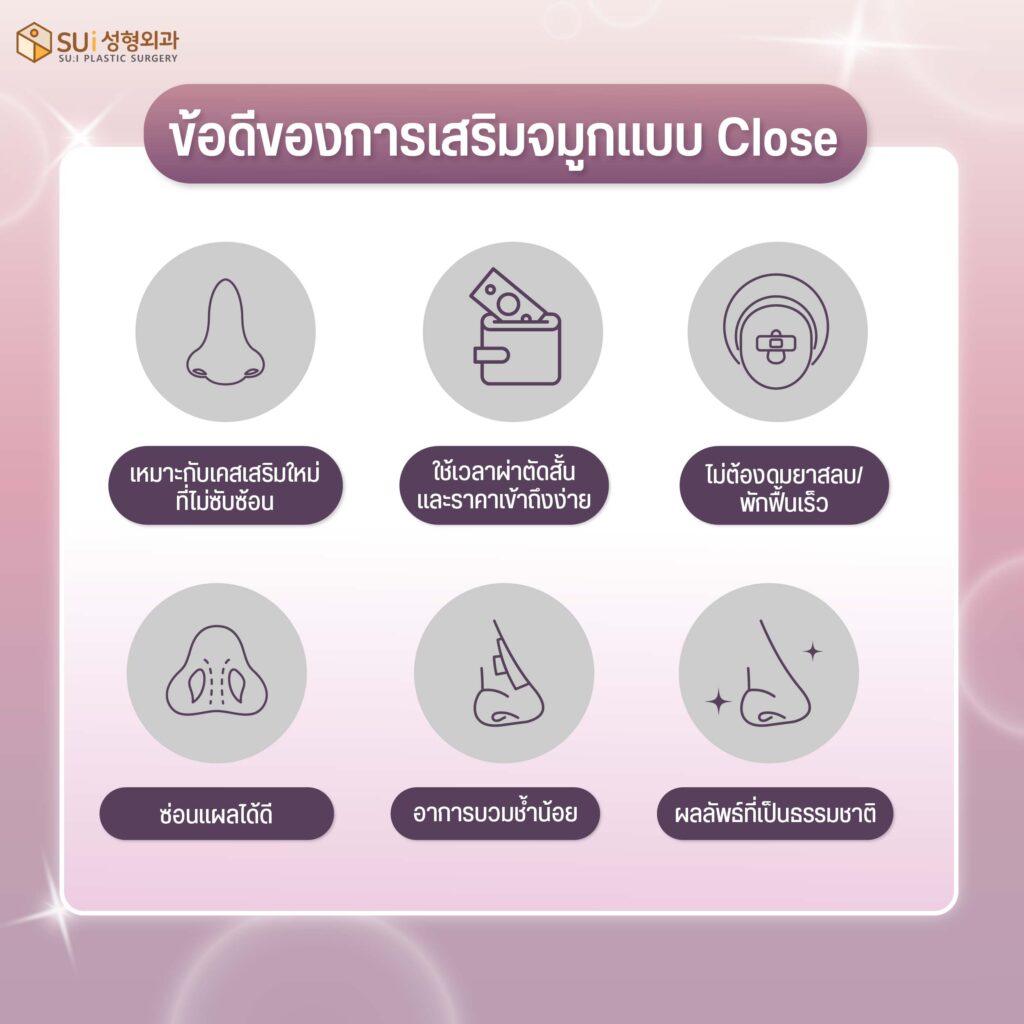 เสริมจมูกแบบ Close ข้อดี