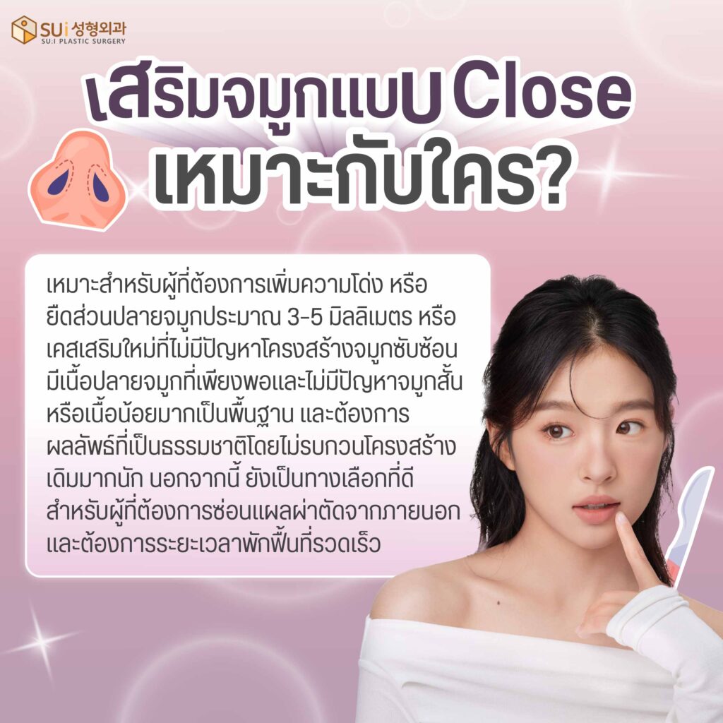 เสริมจมูกแบบ Close เหมาะกับใคร
