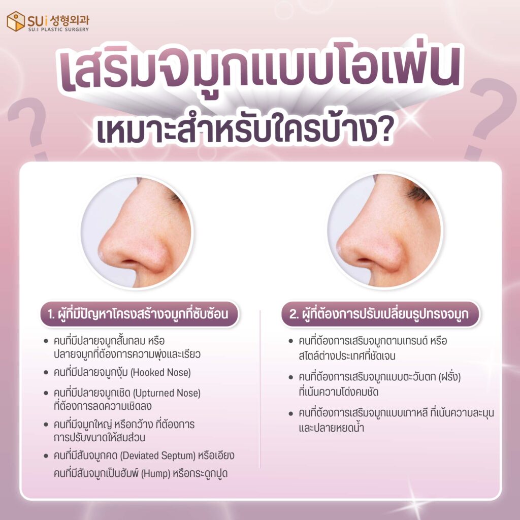 เสริมจมูกแบบโอเพ่น เข้ากับใคร