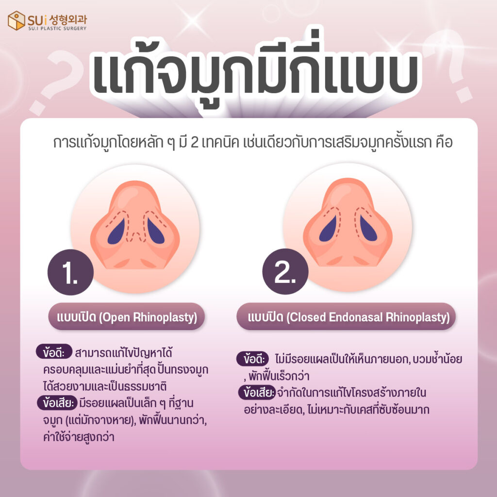 การแก้จมูกมีกี่แบบ