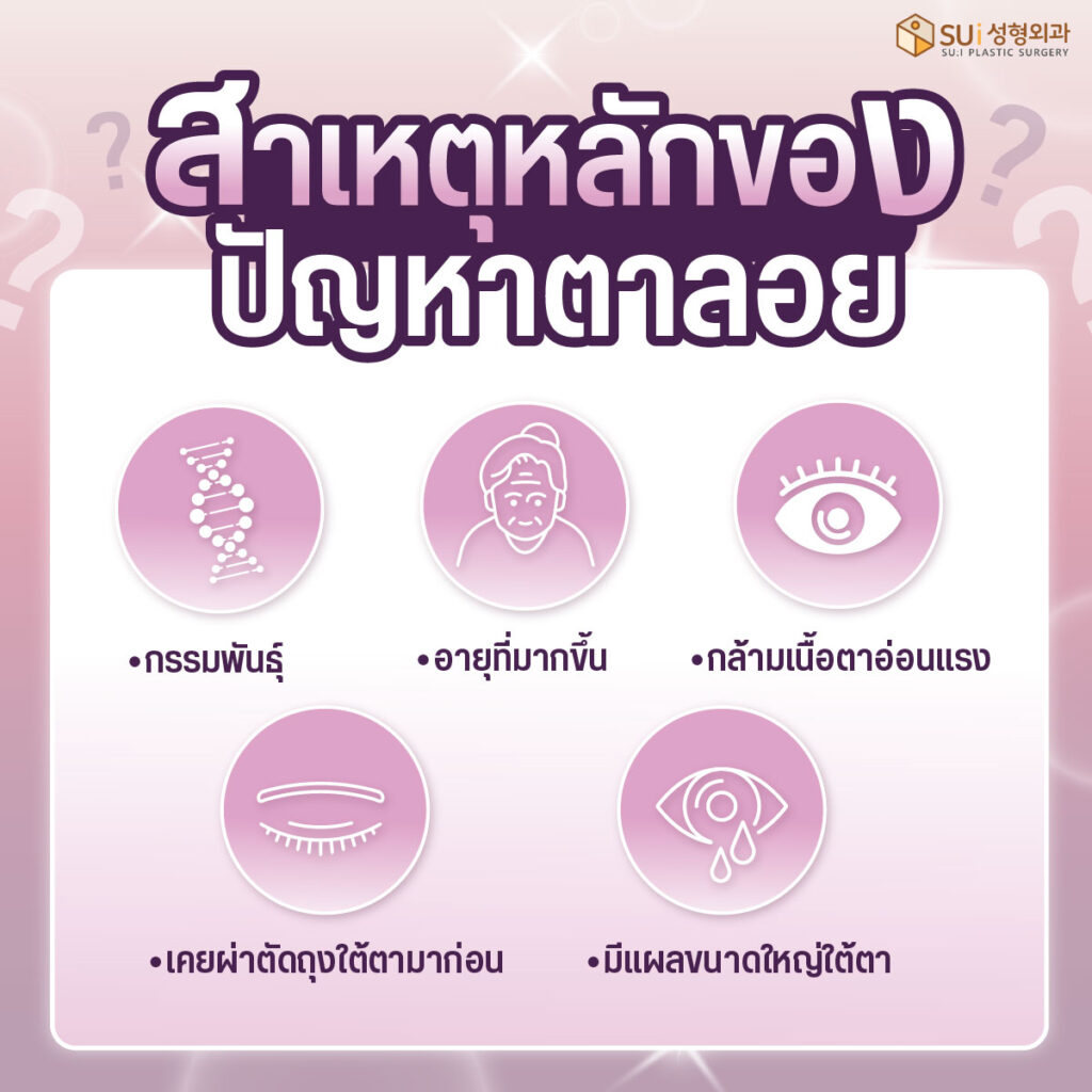 สาเหตุของการเกิดปัญหาตาลอย