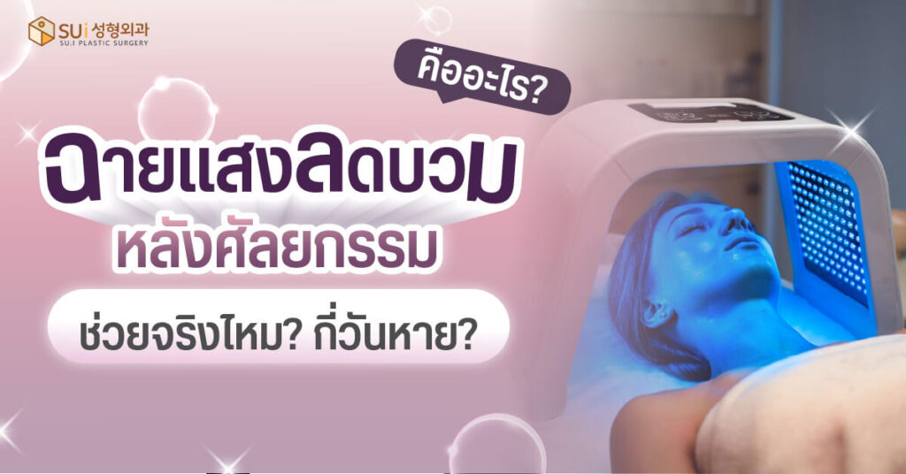 การฉายแสงลดบวมหลังศัลยกรรม