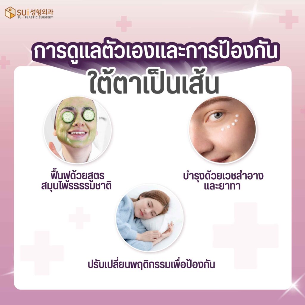 การดูแลตัวเองและป้องกันใต้ตาเป็นเส้น