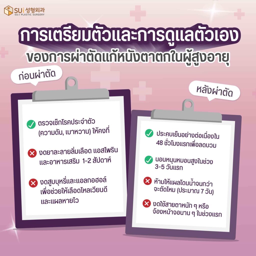 การเตรียมตัวก่อนผ่าตัดแก้หนังตาตกในผู้สูงอายุ