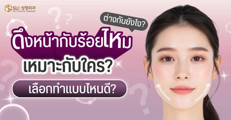 ดึงหน้ากับร้อยไหม แต่ละแบบเหมาะกับใคร