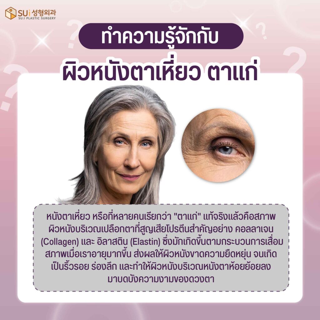 ผิวหนังตาเหี่ยว
