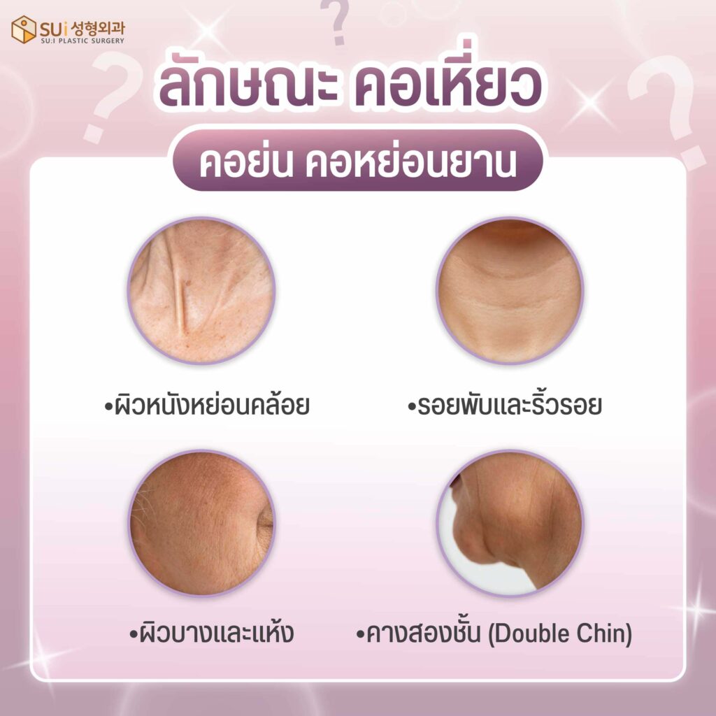 ลักษณะ คอเหี่ยว คอย่น