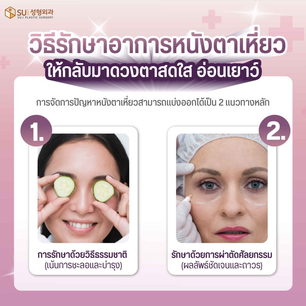 วิธีรักษาอาการหนังตาเหี่ยว