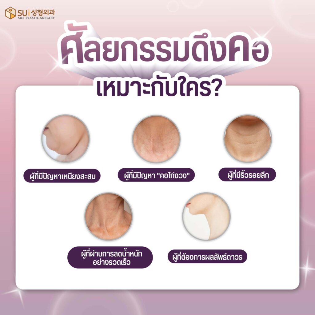 ศัลยกรรมดึงคอเหมาะกับใคร