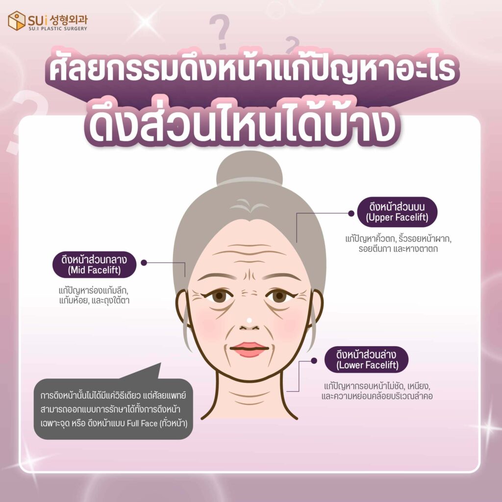 ศัลยกรรมดึงหน้าแก้ปัญหาจุดไหนบ้าง