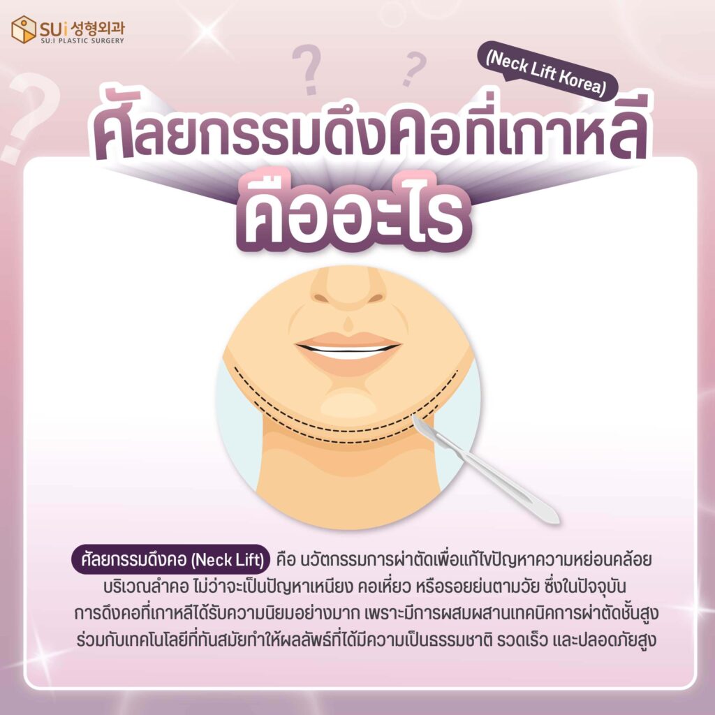 ศัลยกรรมเดึงคอ คืออะไร