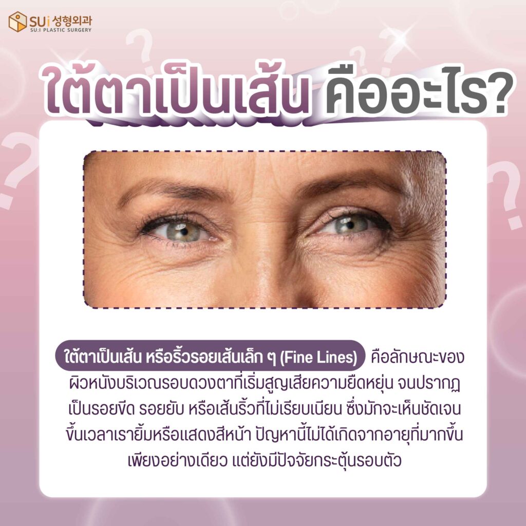 ใต้ตาเป็นเส้น คืออะไร