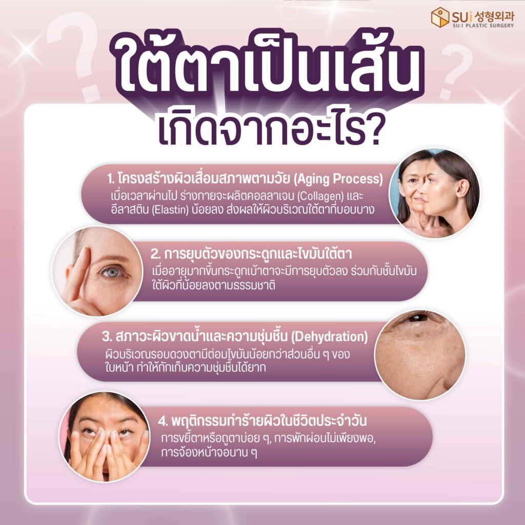 ใต้ตาเป็นเส้นเกิดจากอะไร