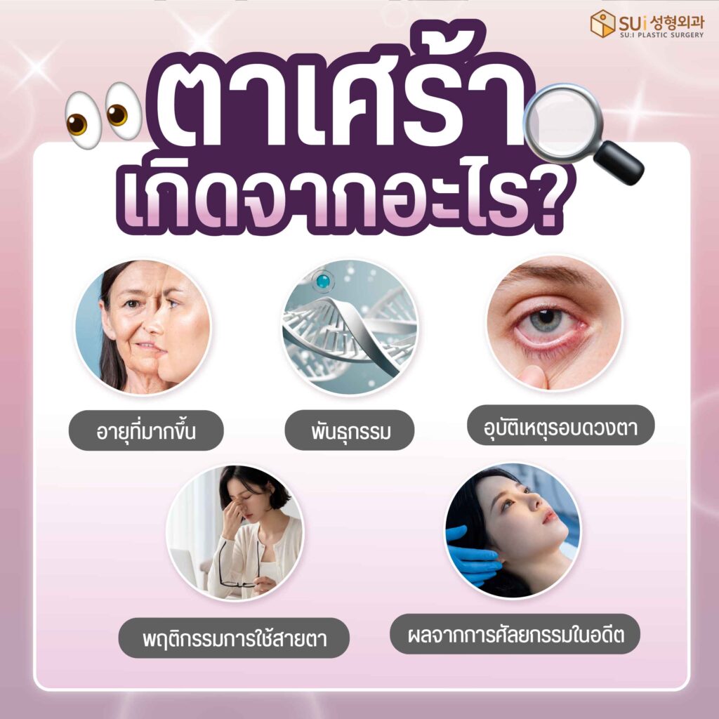 ตาเศร้า เกิดจากอะไร
