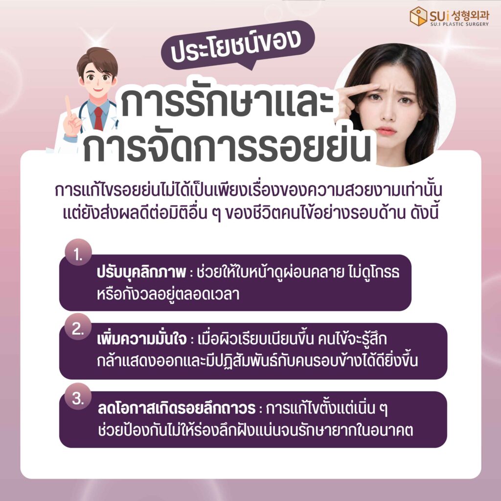 รอยย่นระหว่างคิ้ว ข้อดีหลังการแก้ปัญหาช่วยอะไร